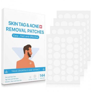 Plasturi pentru Indepartarea Negilor si Cosurilor, Set Tratament Local 144 bucati